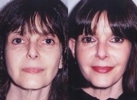 Facelift - Before and After Treatment Photos - female, front view, patient 6